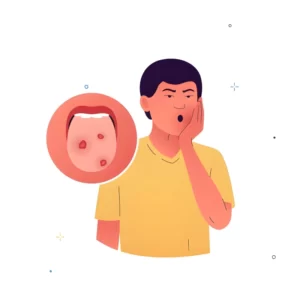 چگونه از سرطان دهان جلوگیری کنیم - علل