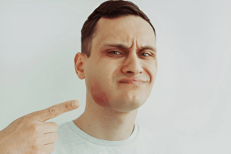 درمان کیست فک - بهترین دکتر کیست فک در تهران