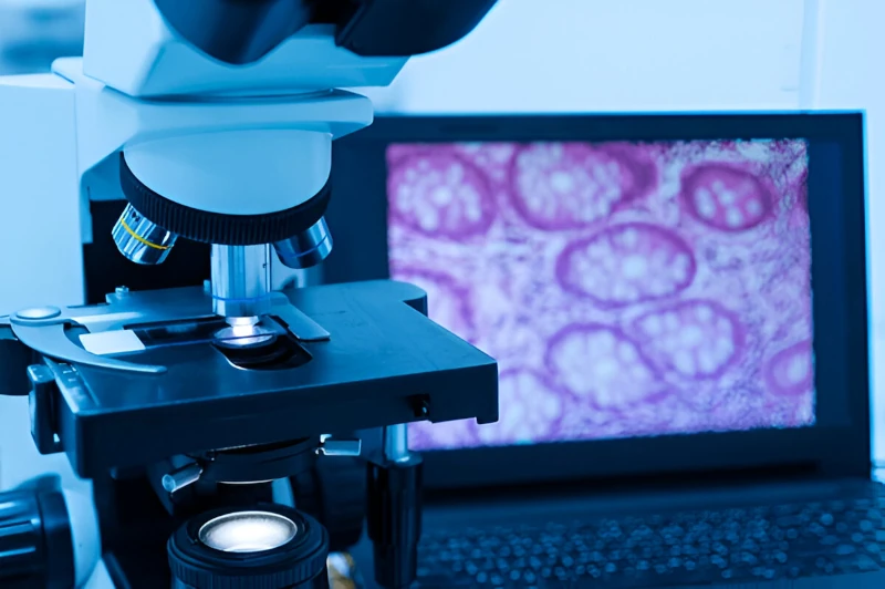 درمان کیست فکی در میرداماد - تشخیص